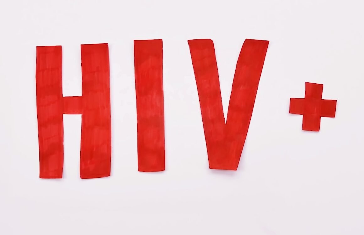לחיות עם HIV איידס